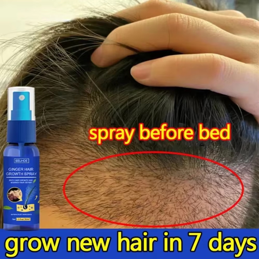 Hair Care Lotion - 速効性ジンジャーヘアグローススプレー、毛根育成、脱毛防止、育毛セラム、頭皮ダメージ修復、栄養ケア製品、女性男性用